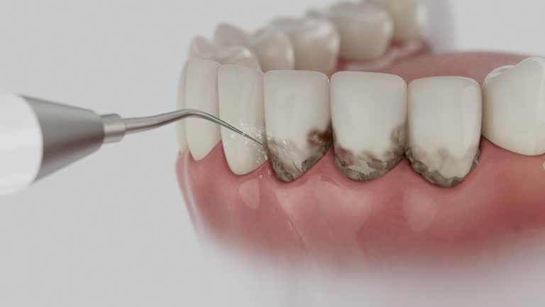 Reliable Emergency Dentist contractor in South Gate, CA by Smile Center Dentistry